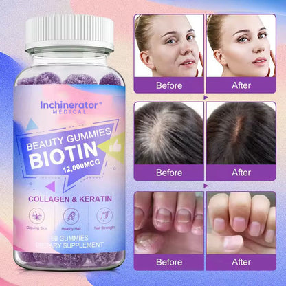 Beauty Gummies - Collagen + Biotin 12,000MCG